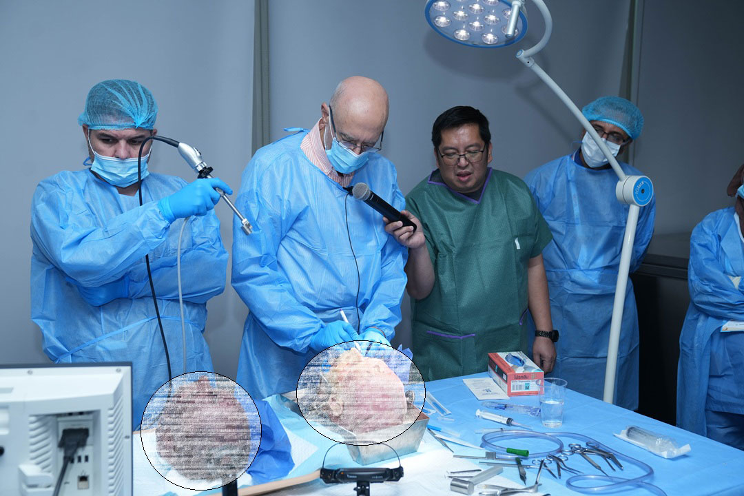 14TH AESTHETIC AND FUNCTIONAL SEPTORHINOPLASTY COURSE WITH HANDS-ON CADAVER DISSECTION: STEP BY STEP RHINOPLASTY & SEPTOPLASTY - Image 1