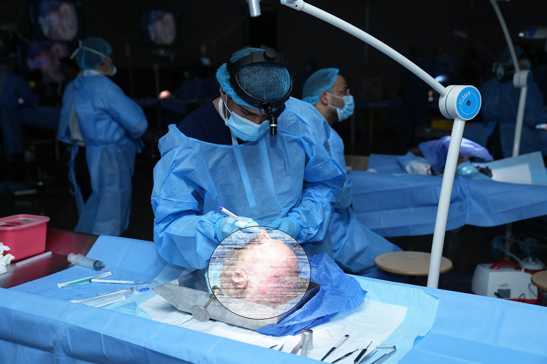14TH AESTHETIC AND FUNCTIONAL SEPTORHINOPLASTY COURSE WITH HANDS-ON CADAVER DISSECTION: STEP BY STEP RHINOPLASTY & SEPTOPLASTY - Image 3
