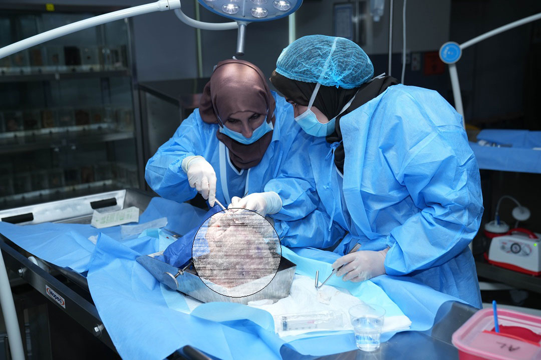14TH AESTHETIC AND FUNCTIONAL SEPTORHINOPLASTY COURSE WITH HANDS-ON CADAVER DISSECTION: STEP BY STEP RHINOPLASTY & SEPTOPLASTY - Image 4