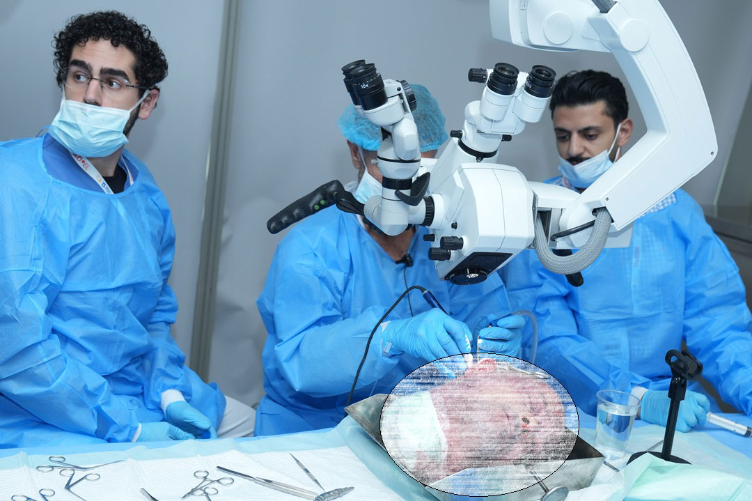 14TH TEMPORAL BONE DISSECTION COURSE WITH HANDS-ON HEARING IMPLANT - Image 3